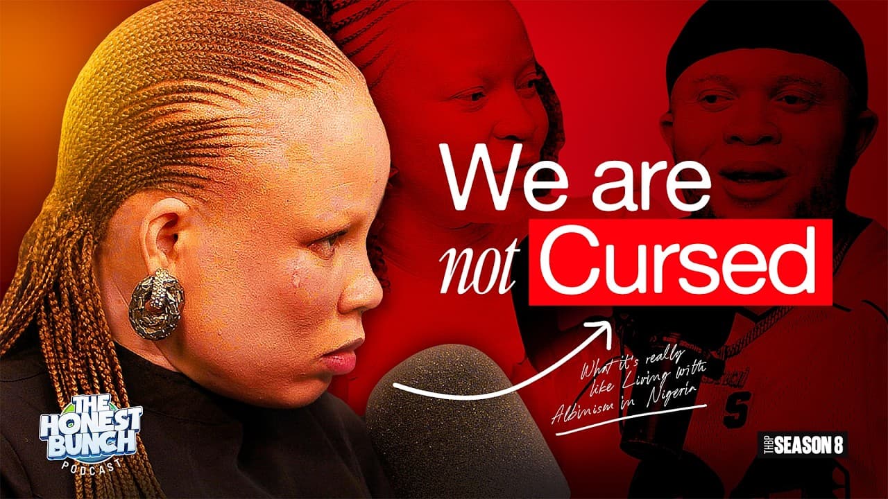 What It’s REALLY Like Living With Albinism in Nigeria | The Honest Bunch Podcast