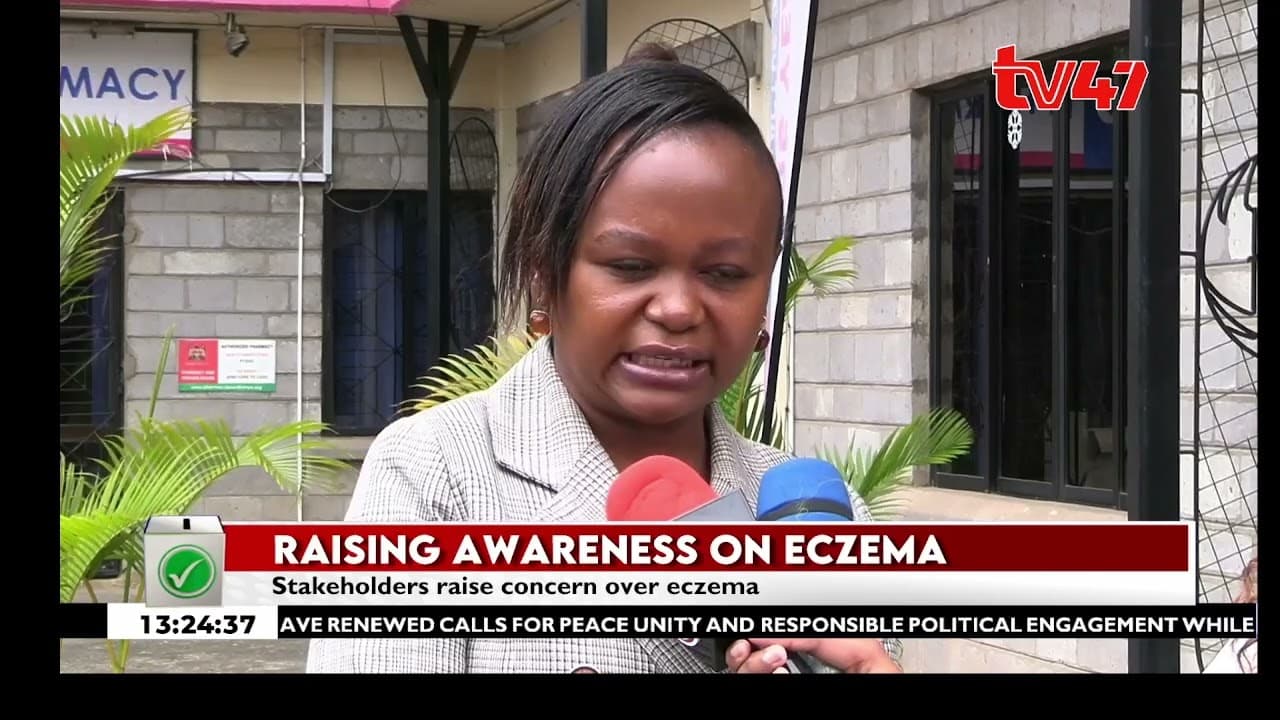 Eczema cases rise as stakeholders call for affordable treatment and an end to stigma
