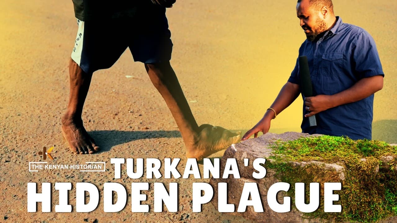 "Uncovering Turkana's Silent Plague: The Gruesome Disease Crippling a Region"