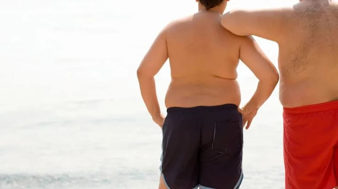 WHO says no obesity drugs, surgery for under-10s