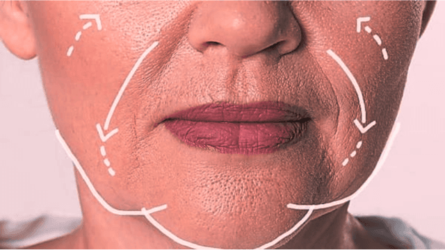 7 Ways To Deal With Sagging Skin