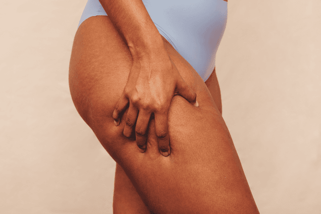 Skincare: How To Get Rid Of Cellulite
