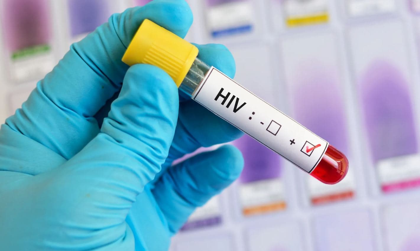 HIV Infections Rise 19% in Kenya as Nairobi Emerges as National Hotspot