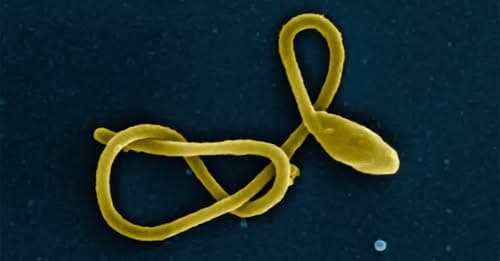 Pharmacists told to be on alert as Kenya confirms imported Ebola case
