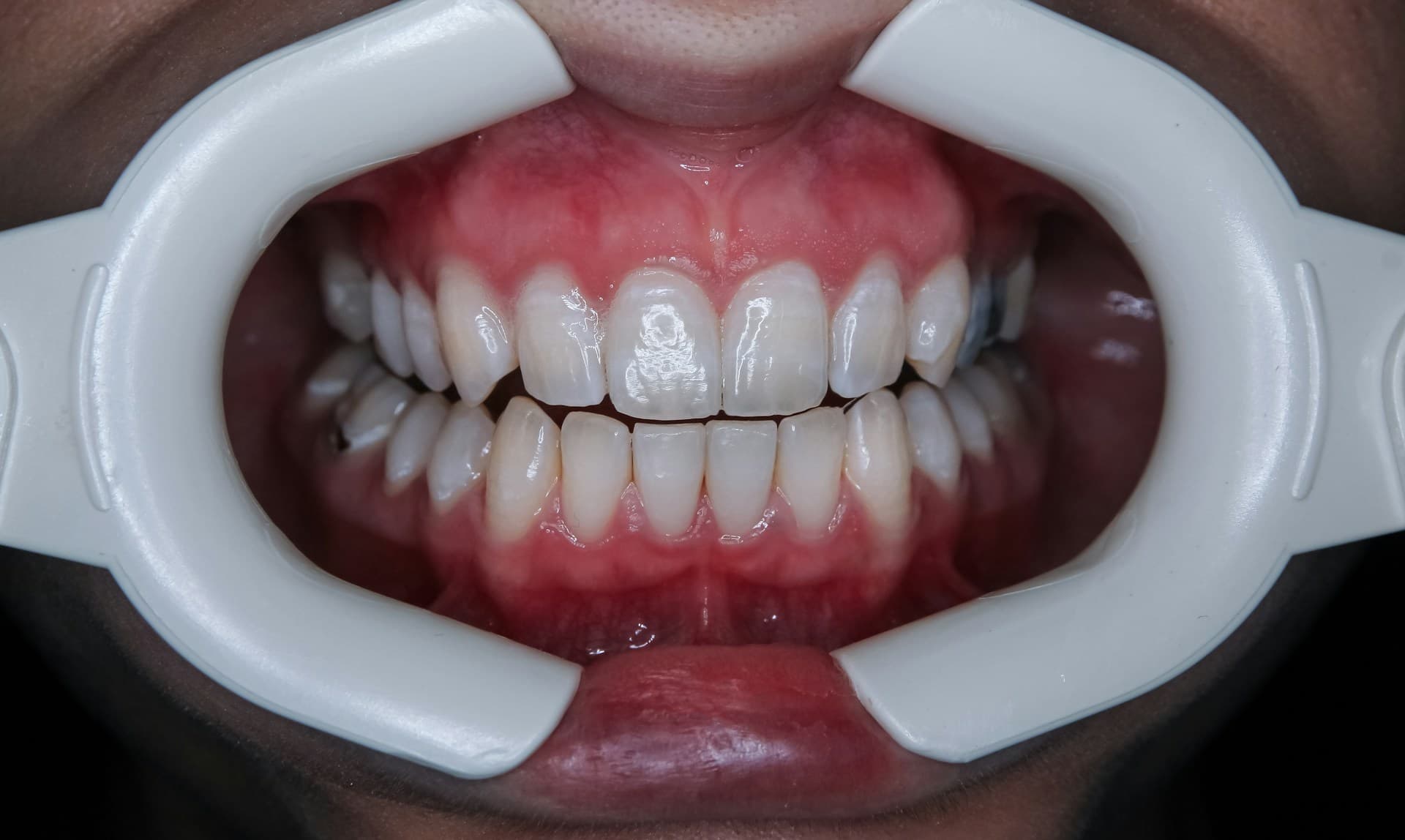 Why a multi-stakeholder approach is key to making oral health a national priority