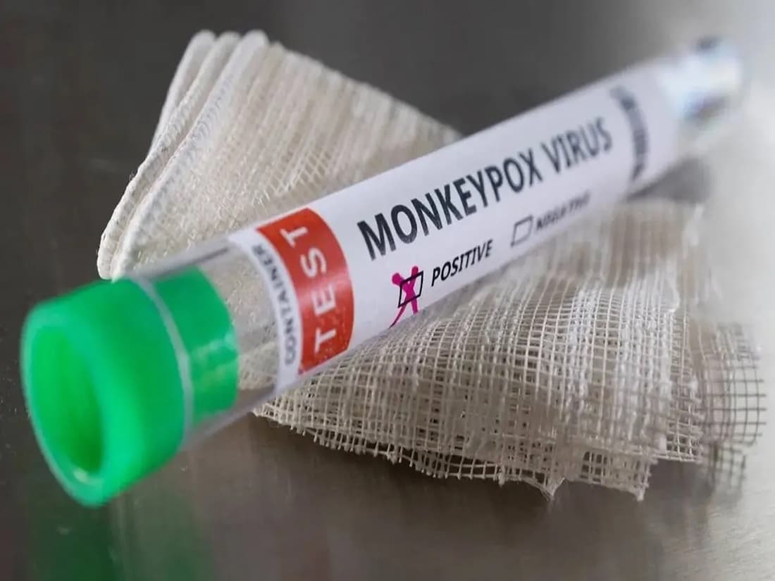 Kenya Issues Update on Mpox Patient After WHO Alert