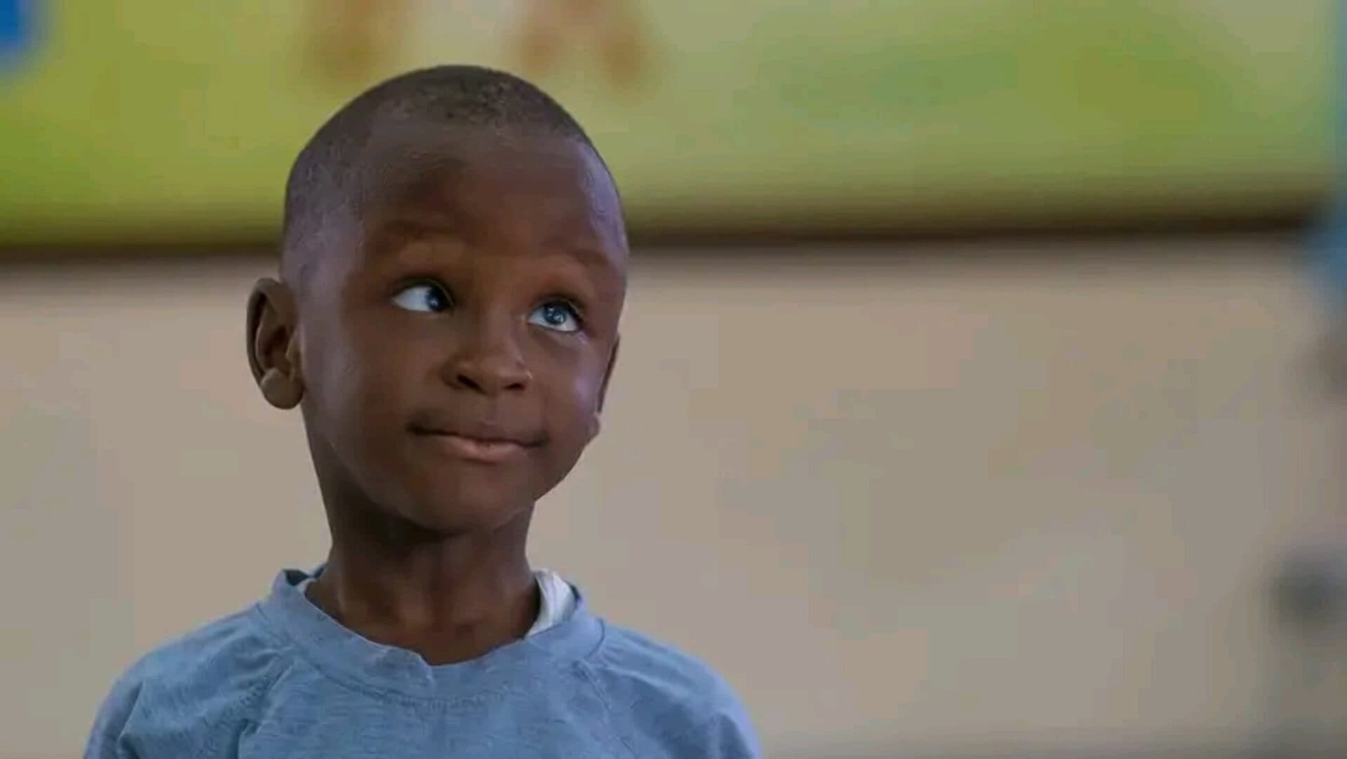 Squint in Children (Strabismus): How to help your child regain normal sight