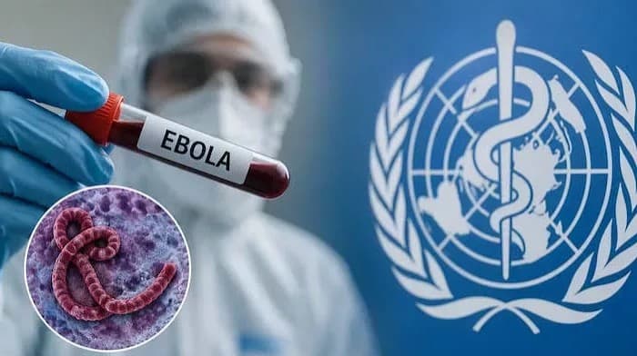 UN allocates Kenya Sh 258 million for Ebola response