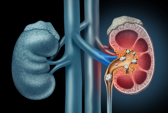 Foods To Eat For Healthy Kidneys