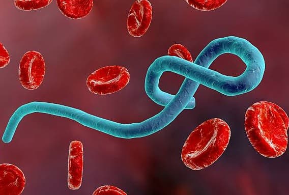 Kenya on high Ebola alert