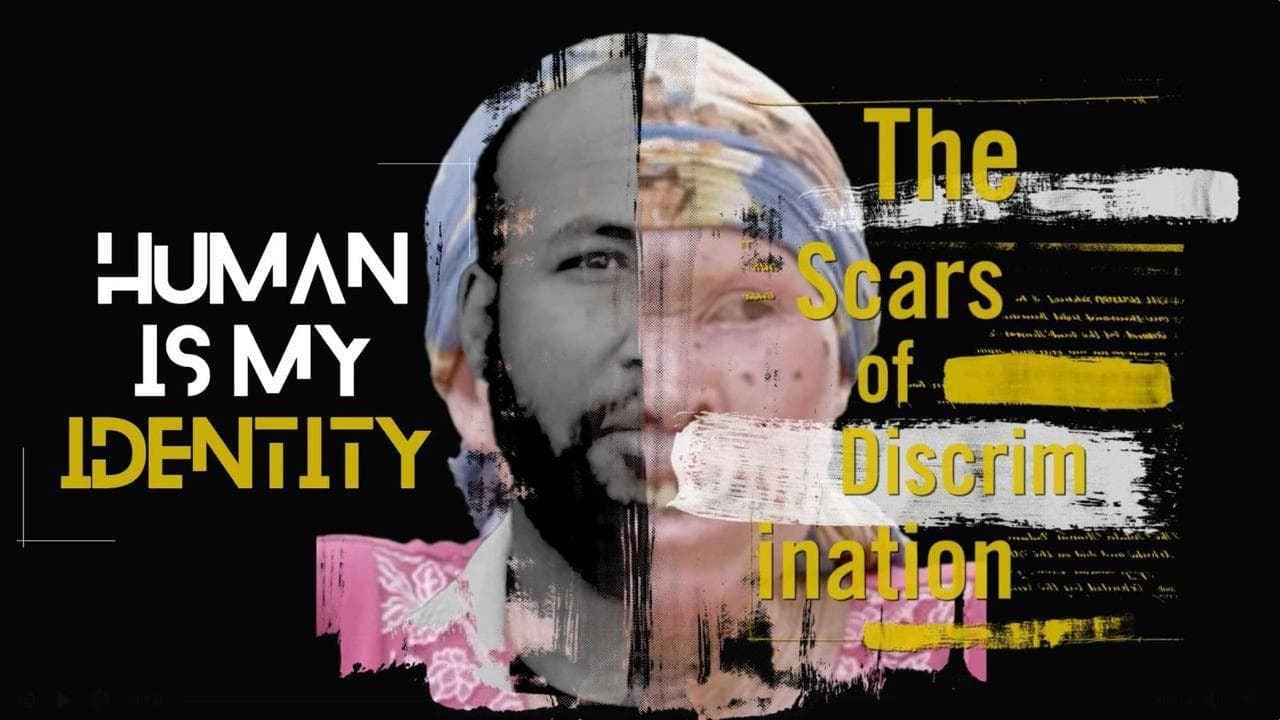 Human is My Identity: The Scars of Discrimination
