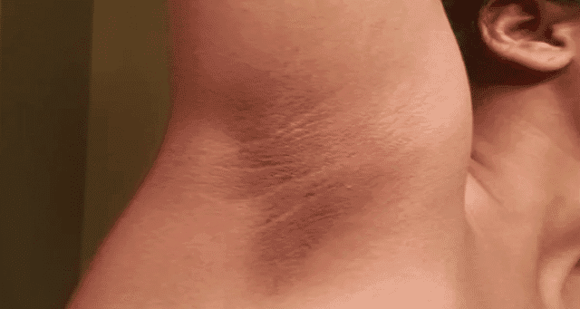 Skincare: 6 Ways To Brighten Dark Armpits