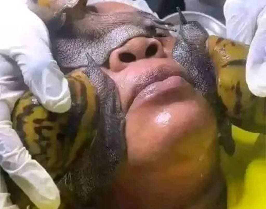 Cosmetic buyers chase snail slime for skin health, opening new market
