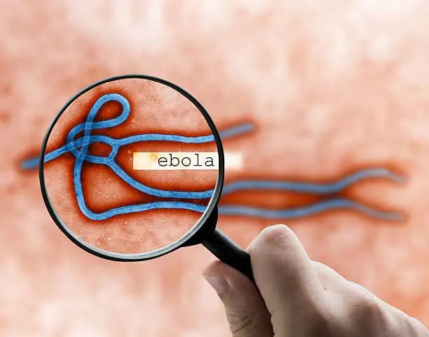 How to Know You Have Contracted Ebola Early