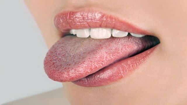 What Your Tongue Says About Your Health