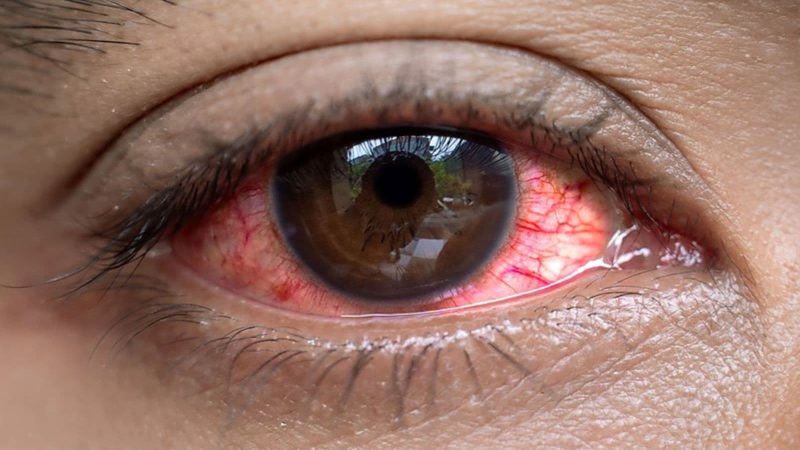 Nakuru County launches plan to improve eye care access