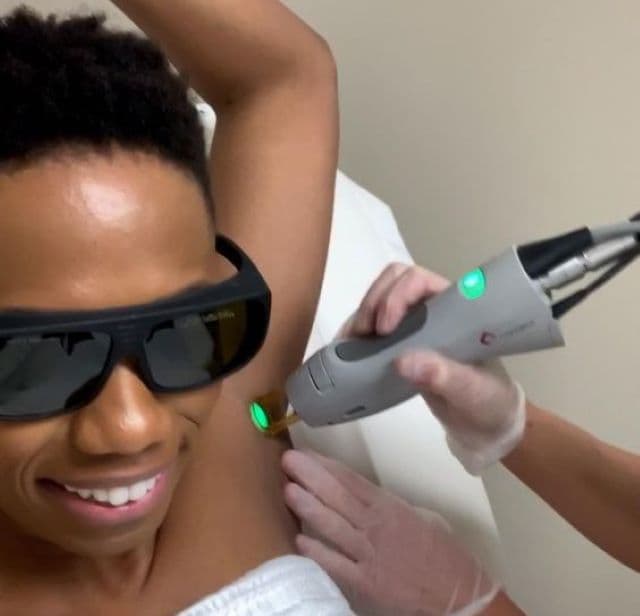 7 Things You Should Know Before Getting Laser Hair Removal