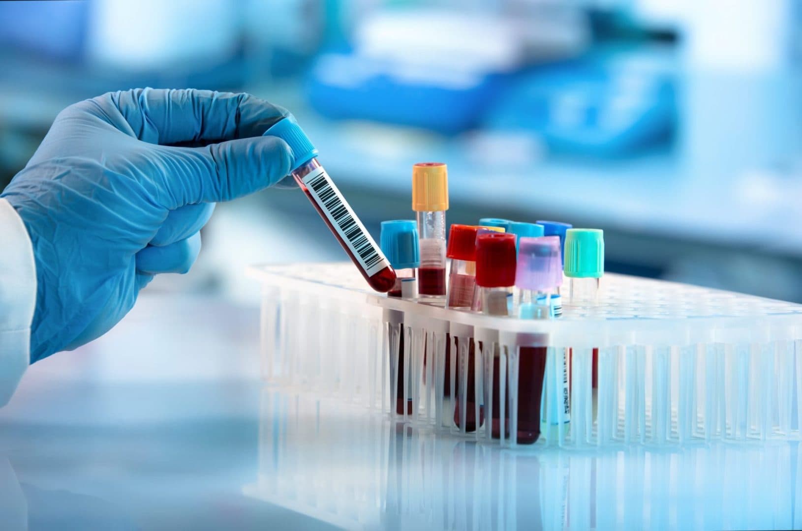 Breakthrough as early signs of Parkinson’s disease identifiable in blood