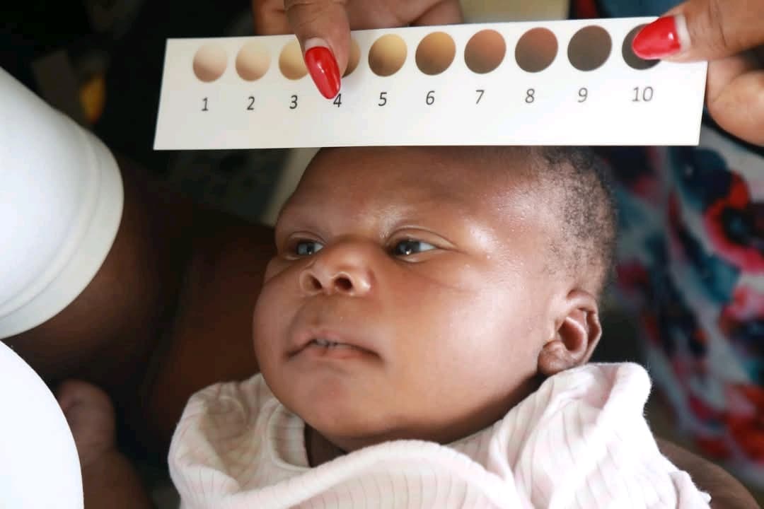Low-cost device offers lifeline in fight against newborn jaundice