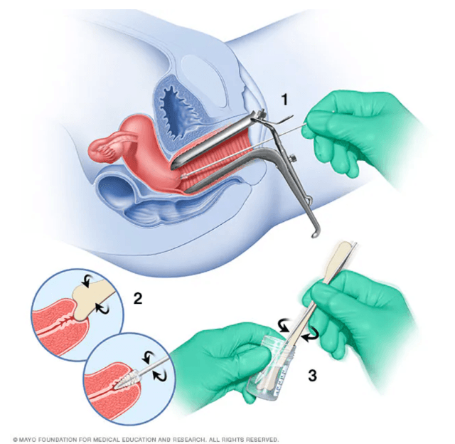 7 Things You Should Know Before Getting A Pap Smear