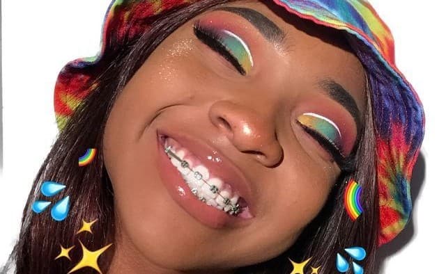 6 Things You Need To Know Before Getting Braces