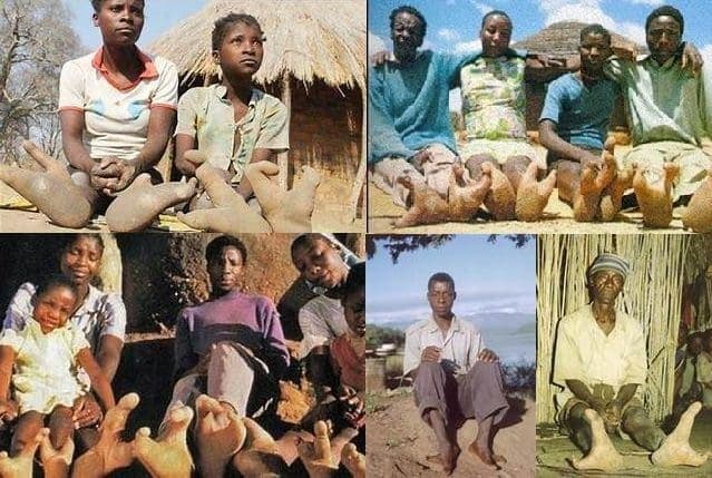 VIDEO: The Extraordinary Ostrich-Footed Tribe of Zimbabwe