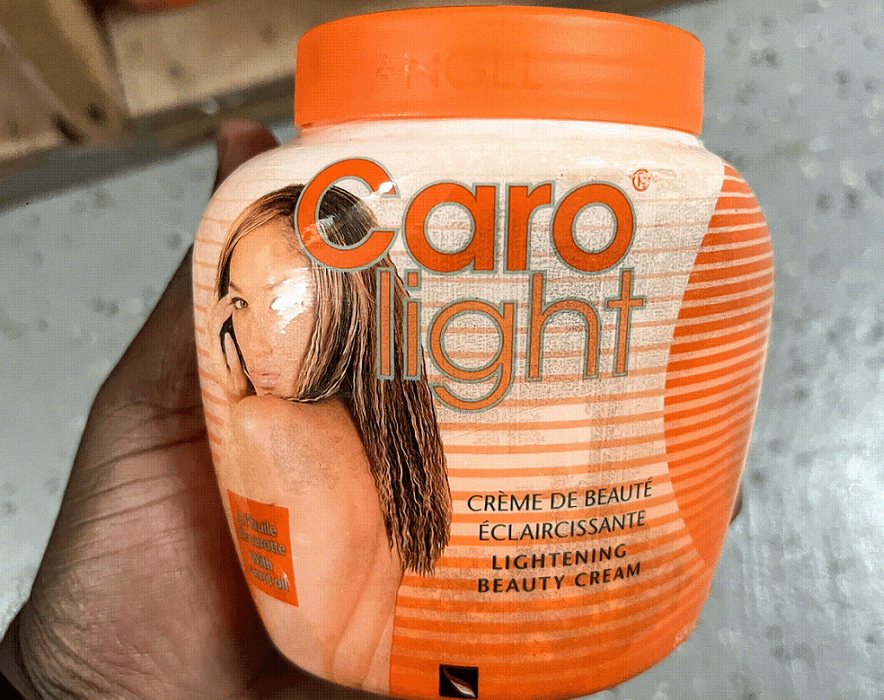 An African’s confusion over the American Diaspora using Carolight skin bleaching