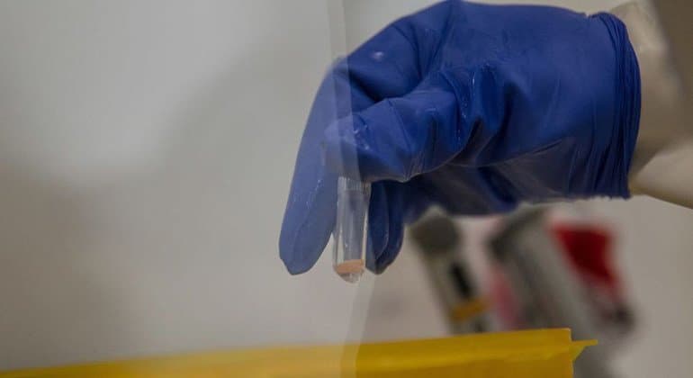 France Reports First Ebola Case