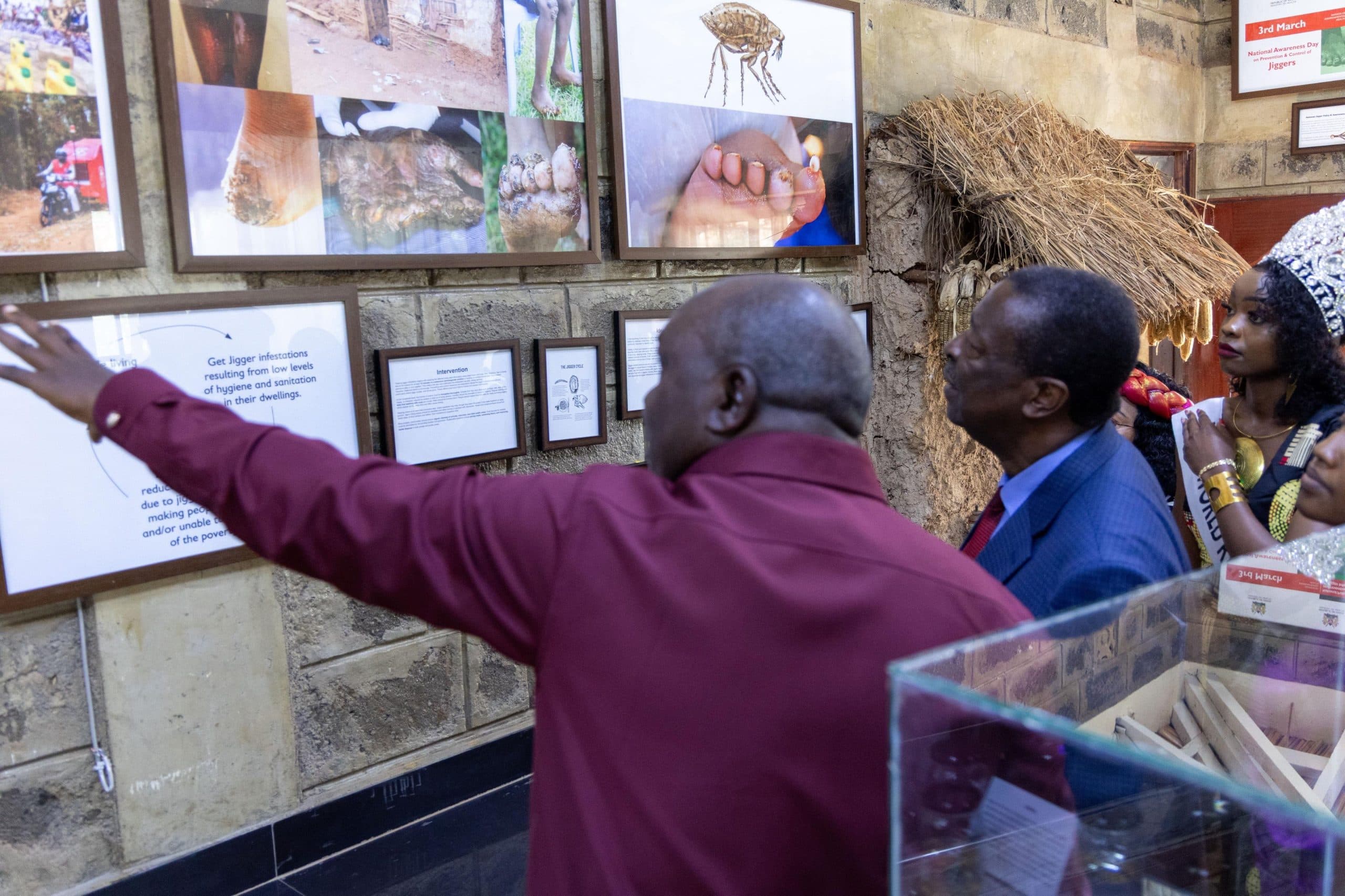 Mudavadi hails Kenya’s progress in war against jigger infestation