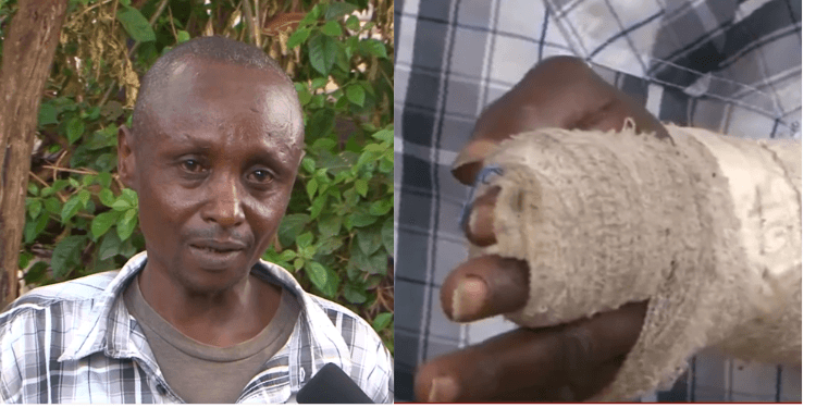 Mysterious Biting Attacker Sparks Fear in Ruiru as Police Launch Hunt