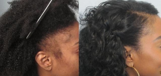 Is Your Hair Too Thin? 5 Ways To Add Volume To It