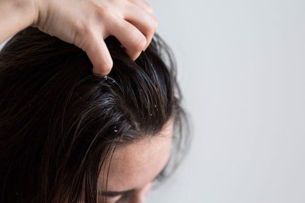 The Right Way to Treat a Flaky, Itchy Scalp