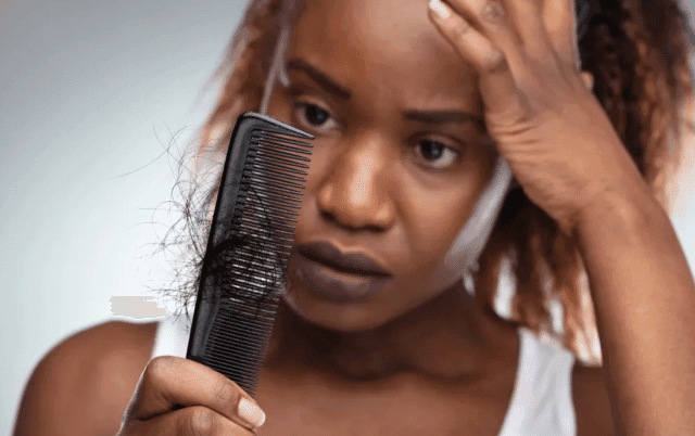 Postpartum Hair Loss – Causes And Treatments To Try