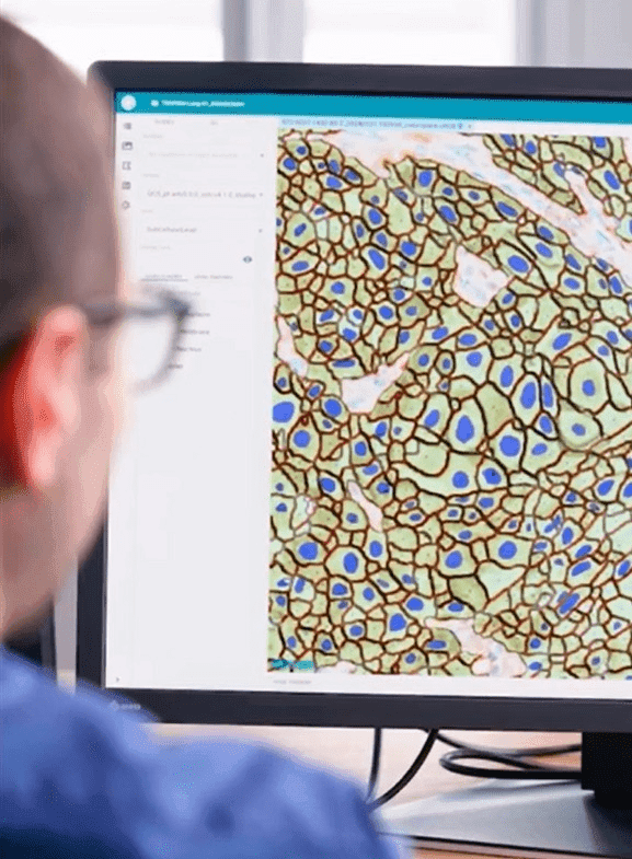AstraZeneca Launches Groundbreaking Initiatives in Cancer Care