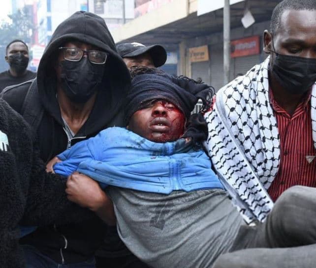 Nairobi Hawker Shot During Protests Undergoes Emergency Surgery